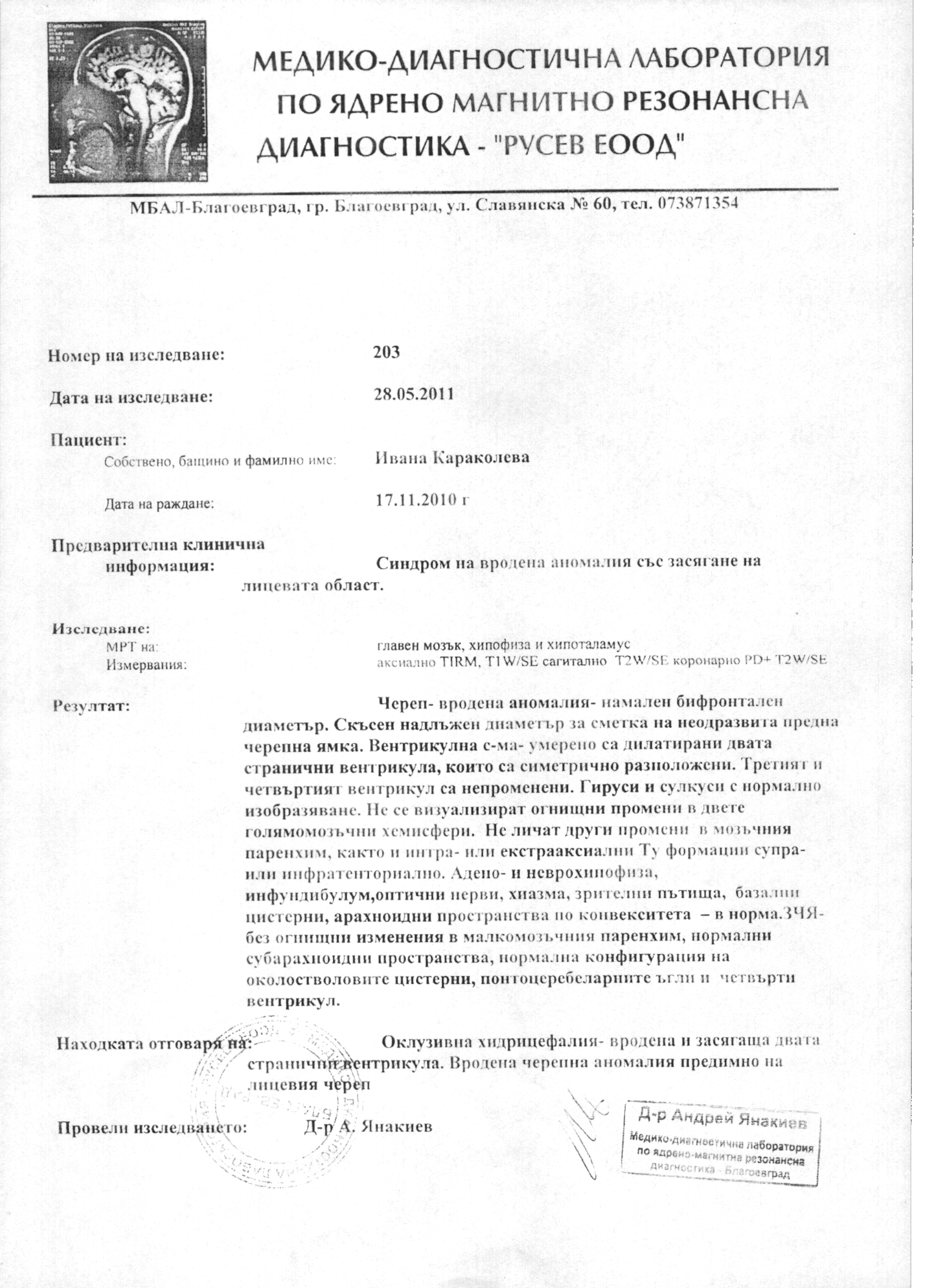 izsledvane