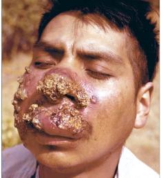 leishmaniosis1