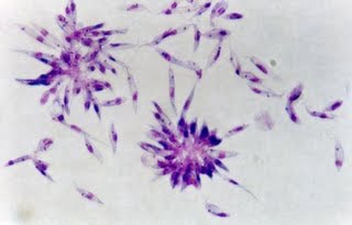 visceralna